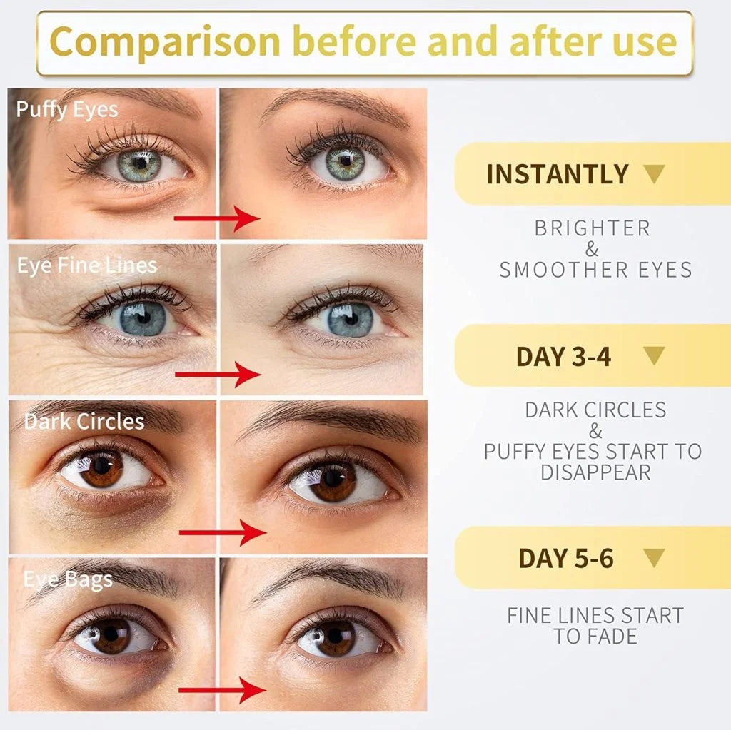 24K Gold Under Eye Patches