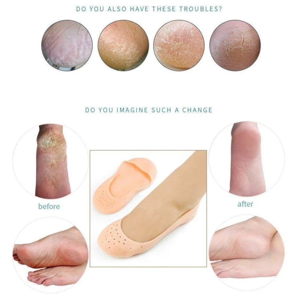 Silicon Socks Anti Crack Full Heel