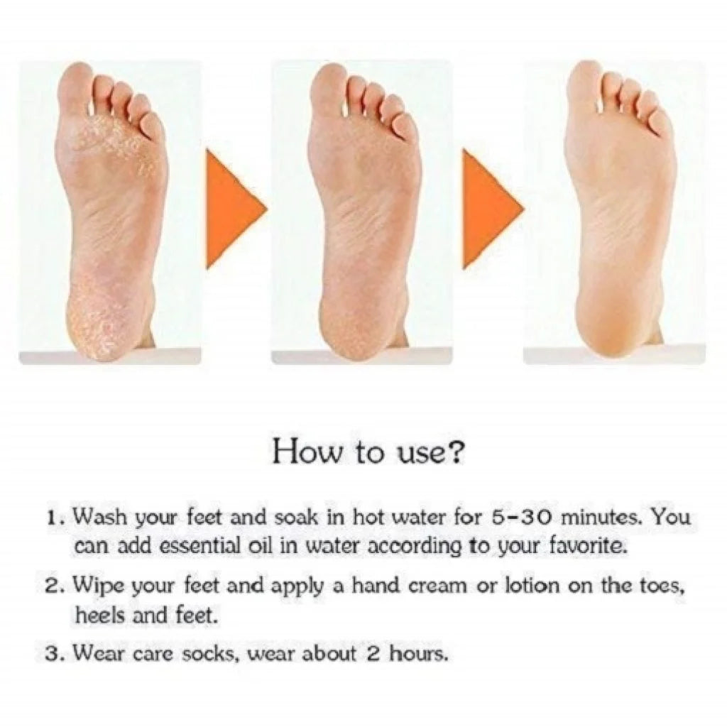 Silicon Socks Anti Crack Full Heel